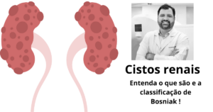 Nódulo renal: o que é e o que fazer com este achado de imagem!