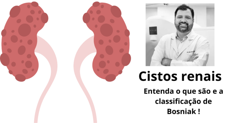 Nódulo renal: o que é e o que fazer com este achado de imagem!