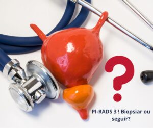 O que é a biópsia de próstata com fusão de imagens em pacientes com Ressonância PI-RADS 4 e PI-RADS 5?