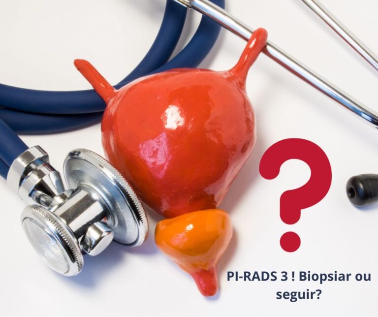 O que é a biópsia de próstata com fusão de imagens em pacientes com Ressonância PI-RADS 4 e PI-RADS 5?